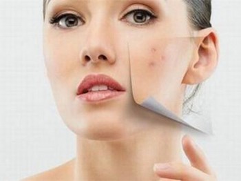 红肿硬大痘痘擦什么药，有效解决炎症痘痘  痘痘 美白祛黄 第5张