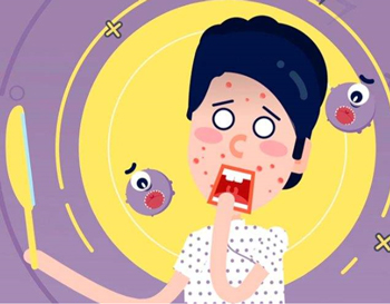 闭口该不该针清，美容院针清闭口详解  闭口 针清 美白祛黄 第5张