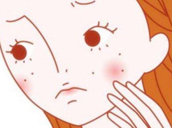 闭口、开口粉刺有什么区别，根据区别找对策  粉刺 美白祛黄 第4张