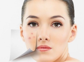 维生素b6去闭口靠谱吗，偏方真假揭秘