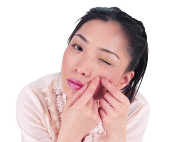 痘痘没挤干净留下硬块，手残挤痘的下场  硬块 美白祛黄 第4张