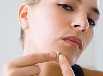 下巴长痘痘是什么原因怎么调理  下巴 痘痘 美白祛黄 第2张