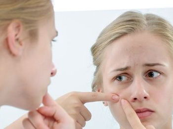 痘痘皮肤的护理方法，学会4种方法