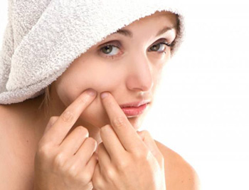 痘痘皮肤的护理方法，学会4种方法  痘痘皮肤 美白祛黄 第2张