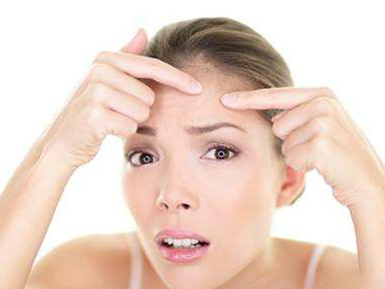 痘痘皮肤的护理方法，学会4种方法  痘痘皮肤 美白祛黄 第4张