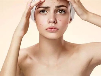 内分泌失调老长痘痘是什么原因怎么办  老长 痘痘 内分泌 美白祛黄 第3张