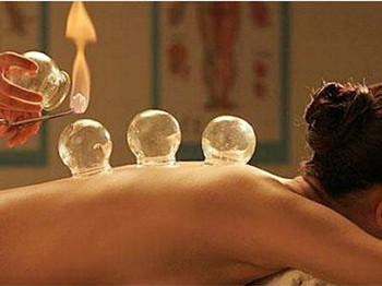 拔火罐能去痘痘吗，看过就知道  火罐 痘痘 美白祛黄 第2张