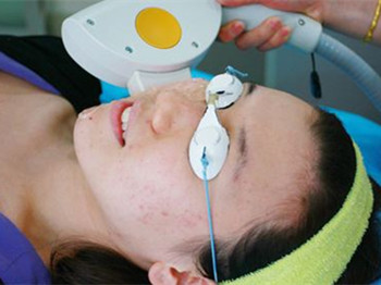 opt祛痘效果怎么样真的有效吗  祛痘 效果 美白祛黄 第3张