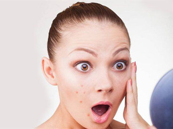 内分泌失调怎么调理脸上老起痘反反复复怎么办