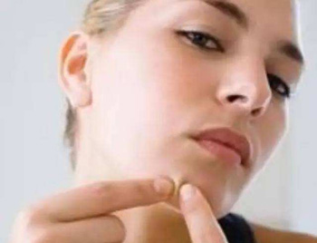 下巴长暗疮又硬又痛什么原因  暗疮 下巴 原因 美白祛黄 第3张