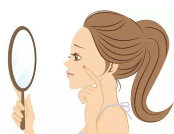 粉刺和痤疮区别，五种区别正确区分疙瘩  痤疮 粉刺 美白祛黄 第3张