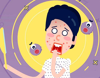 粉刺和痤疮区别，五种区别正确区分疙瘩  痤疮 粉刺 美白祛黄 第4张