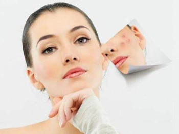 毛囊炎和痤疮的区别，辨别清楚治疗更快  痤疮 美白祛黄 第4张