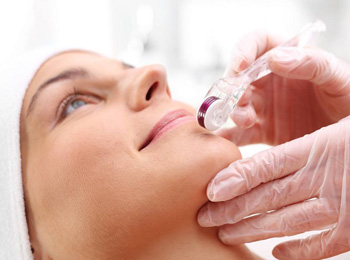 微针祛痘坑几次有效果，怎么护理  祛痘 微针 美白祛黄 第2张