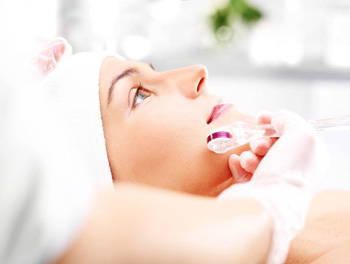 微针祛痘坑几次有效果，怎么护理  祛痘 微针 美白祛黄 第4张