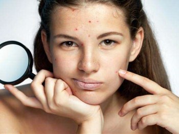 isdin怡思丁疤痕膏去痘印有效果吗  美白祛黄 第4张