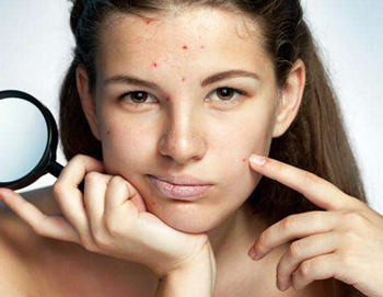 白醋去痘印是真的吗，白醋去痘印法检测  白醋 美白祛黄 第3张