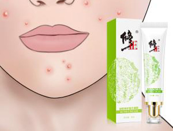 修正牌祛痘印膏怎么样,效果好吗 祛痘印膏 美白祛黄 第4张 修正牌祛痘印膏怎么样,效果好吗 祛痘印膏 美白祛黄 第4张