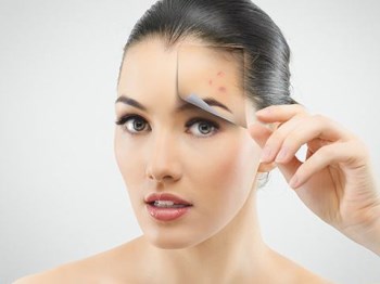 淡化痘印黑色素的方法，别让痘印毁容貌  黑色素 方法 美白祛黄 第3张