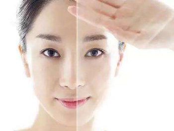 果酸去痘印效果怎么样，有副作用吗  果酸 去痘印 美白祛黄 第3张