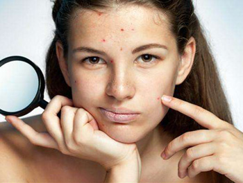 生姜片去痘印效果好吗，正确使用生姜片  生姜片 去痘印 美白祛黄 第2张