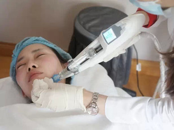 水光针可以去痘印吗,分析“万能”水光针 去痘印 美白祛黄 第2张 水光针可以去痘印吗,分析“万能”水光针 去痘印 美白祛黄 第2张