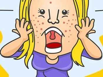 脸部刮痧能去痘印吗，不要盲目进行  脸部 刮痧 美白祛黄 第3张