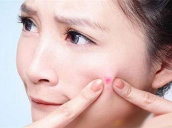 百多邦能去痘印吗，别盲目用药哦  去痘印 美白祛黄 第2张