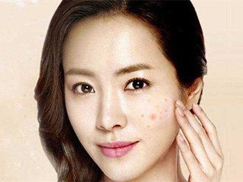 百多邦能去痘印吗，别盲目用药哦  去痘印 美白祛黄 第4张