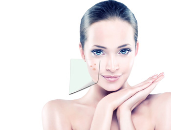 痘印一般多久会消失，分析3种原因  去痘印 美白祛黄 第1张