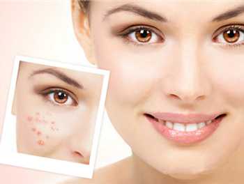 用激光去痘印的危害，盘点4大危害