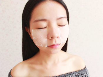 用激光去痘印的危害，盘点4大危害  激光 去痘印 美白祛黄 第2张