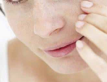 用激光去痘印的危害，盘点4大危害  激光 去痘印 美白祛黄 第3张