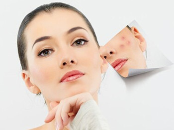 激光祛痘印是永久的吗，看过就知道  祛痘印 美白祛黄 第4张