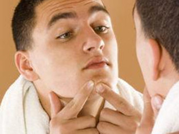 男生祛痘印的日常方法，简单又实用