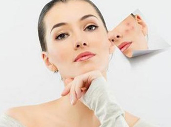 维a酸乳膏去痘印吗，效果怎么样  维a酸乳膏 祛痘印 美白祛黄 第3张