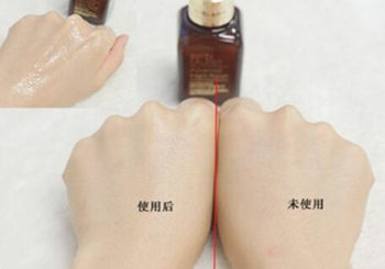 小棕瓶精华适合干皮吗  小棕瓶精华 美白祛黄 第4张