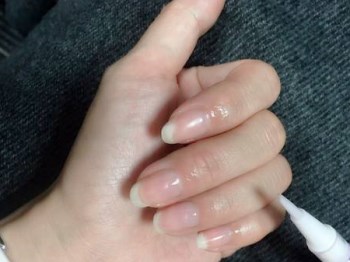 手部起倒刺是什么原因怎么办  倒刺 手部 怎么办 美白祛黄 第5张