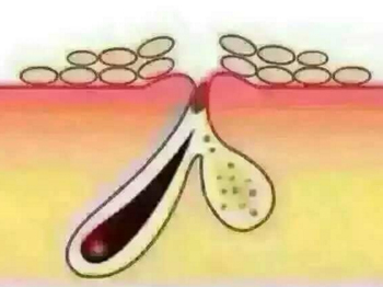 为什么敷面膜脸还是干，秋冬干起皮必看  面膜 美白祛黄 第2张