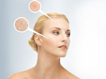 干性皮肤该怎么保养，学会5种方法  干性皮肤 美白祛黄 第4张