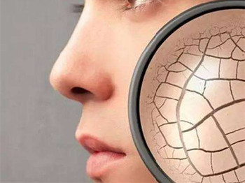 脸部缺水严重怎么补水，五招给肌肤喝饱水