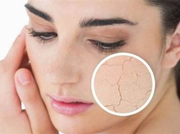 脸部缺水严重怎么补水，五招给肌肤喝饱水  脸部 美白祛黄 第2张