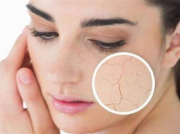 皮肤干燥是什么原因，六大根本原因