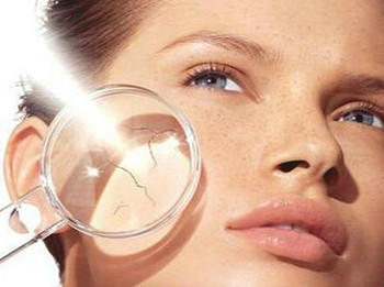 脸上皮肤干燥起皮怎么办，五种改善小方法  皮肤干燥 美白祛黄 第4张