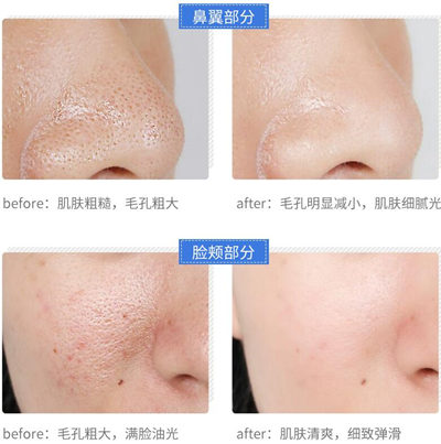 毕克蜂王浆净灿毛孔紧致精华液管用吗  毕克 蜂王浆 精华液 美白祛黄 第4张