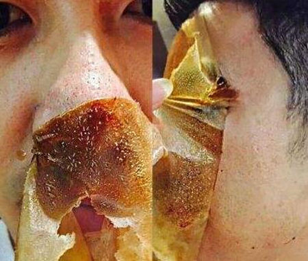 抹了面霜黑头会变多怎么回事如何减少  黑头 面霜 美白祛黄 第6张