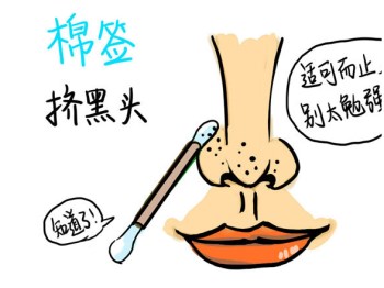 如何正确挤黑头不伤皮肤，最大限度保护肌肤  黑头 皮肤 美白祛黄 第4张