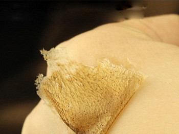 撕拉面膜会拉大毛孔么，别让肌肤受伤害  毛孔粗大 美白祛黄 第2张