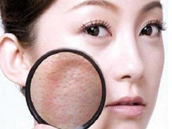 熬夜毛孔粗大如何改善，简单五招恢复美肌