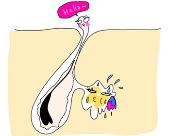 如何判断毛孔堵塞，教你正确判断毛孔问题